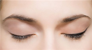 纳米无痕双眼皮怎么办?哪些人适合做纳米无痕双眼皮?