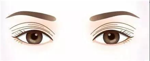 抽脂对眼袋有什么好处?
