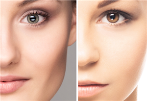 武汉应该做什么形状才能让双眼皮好看呢?如何选择适合你的双眼皮?