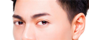 割双眼皮有什么害处?重睑手术的主要风险和并发症是什么?