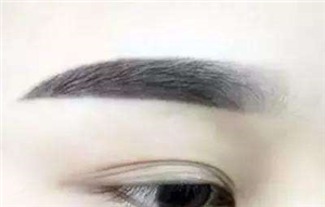 一只眼睛是双眼皮,另一只是单眼皮。可不可以只做一只眼睛吗?