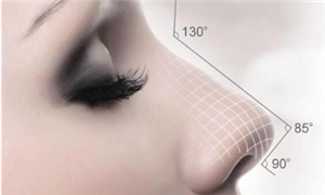 什么样的鼻子才算好看?鼻子整形手术会失败吗?