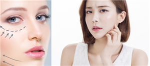 隆鼻手术是否会影响鼻子的正常功能?