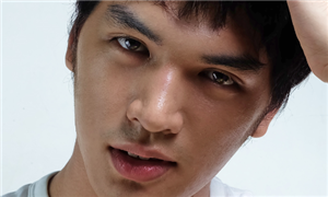 膨体隆鼻恢复时间需要多久呢?