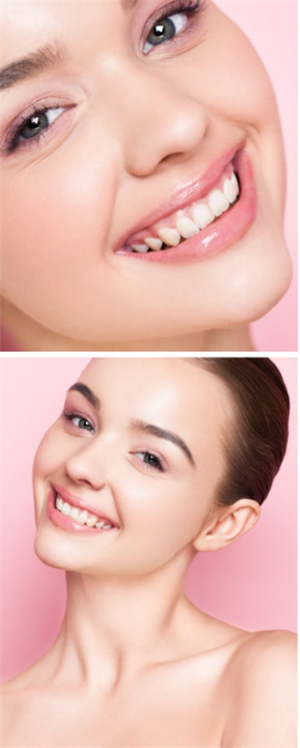 丰厚的自体脂肪额头,显露出大福大贵的模样。