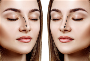 苏州注射瘦脸肉毒素有什么效果和特点?