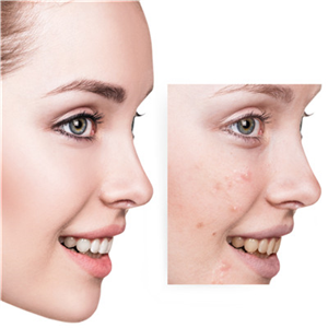 手术伤口修复后要知道的四大点!