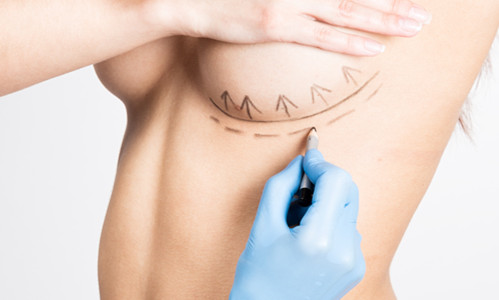 专家介绍,隆胸需要注意的三大问题