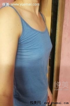 告别平胸360CC让我成为自信女人