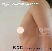 告别平胸360CC让我成为自信女人