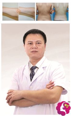 游万福院长光纤溶脂的案例 游万福院长光纤溶脂的案例