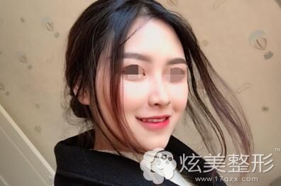 北京圣贝口腔牙齿正畸案例 北京圣贝口腔牙齿正畸案例