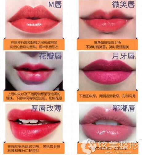 常见的唇部整形项目 常见的唇部整形项目