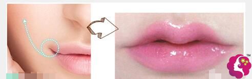 什么是微笑唇 什么是微笑唇