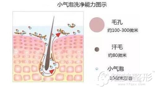 小气泡护肤的原理图 小气泡护肤的原理图