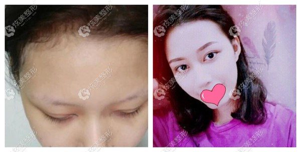 宋桂霞医生做眼修复<span style= 宋桂霞医生做眼修复<span style=