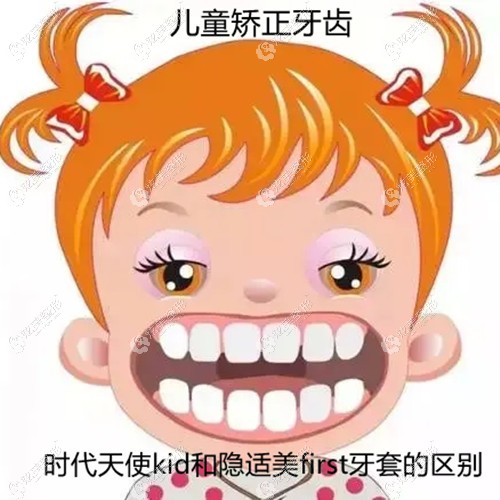 时代天使kid和隐适美first隐形牙套区别是什么 时代天使kid和隐适美first隐形牙套区别是什么