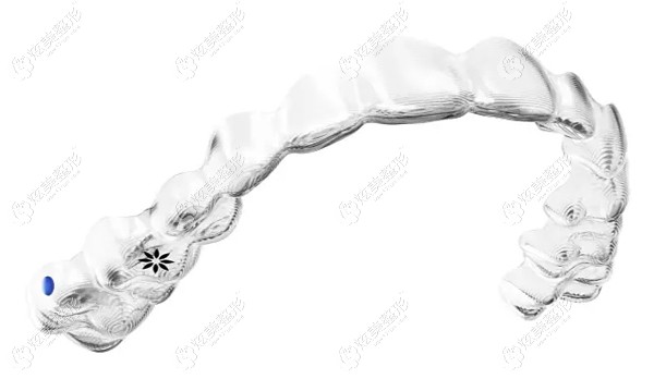 隐适美First矫正牙套有标志 隐适美First矫正牙套有标志