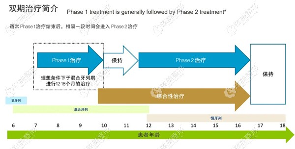 隐适美矫正牙齿分2期进行 隐适美矫正牙齿分2期进行