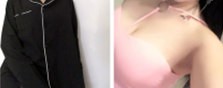 济南海峡整形赵峰医生做沸腾沟丰胸的前后对比差别挺大的