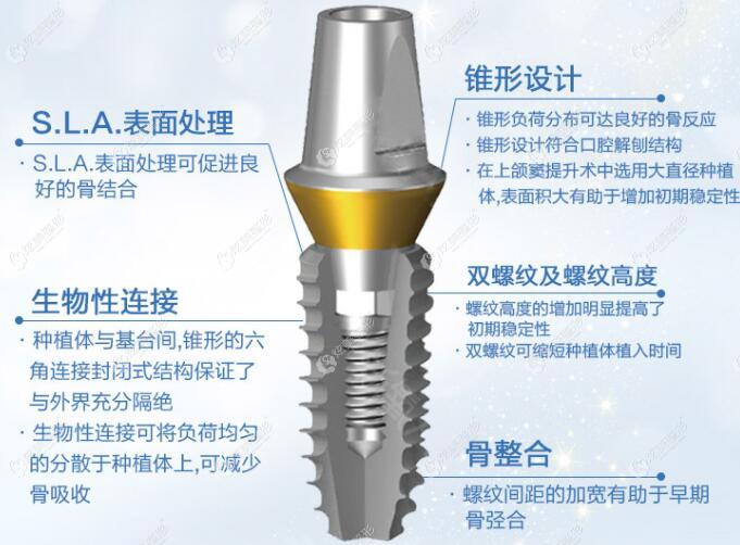 韩国登腾种植体的特点 韩国登腾种植体的特点