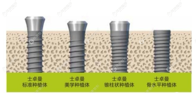 瑞士iti种植体的特点 瑞士iti种植体的特点