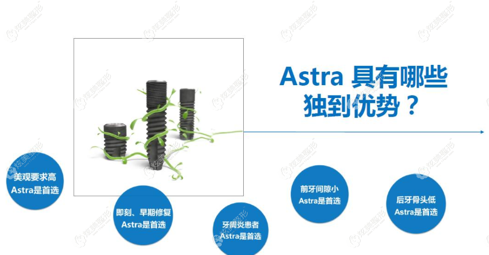 瑞典astra种植体的优势 瑞典astra种植体的优势