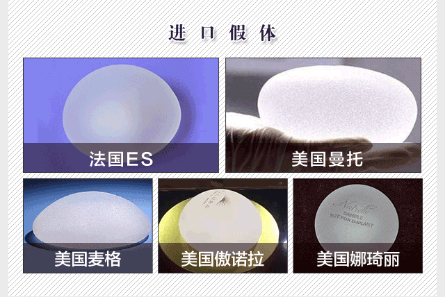 徐国建隆胸多少钱?徐国建假体丰胸2万起价格不贵丰胸技术好