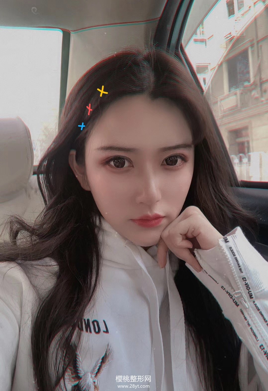 福州格莱美任正义做双眼皮如何?附真人案例+2021最新价格表一览