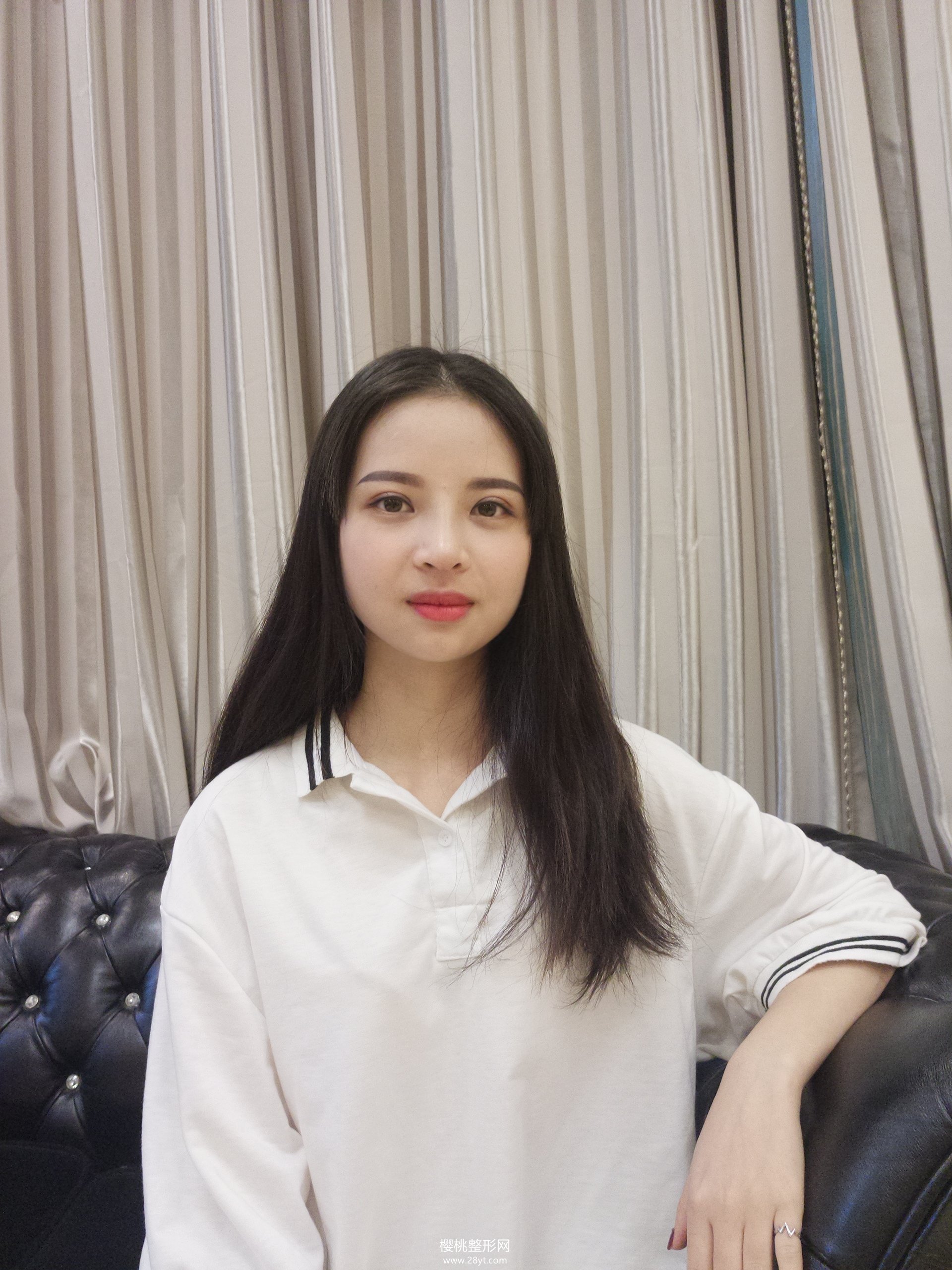 福州名韩察鹏飞隆鼻技术怎样?附真人案例+2021最新价格表一览