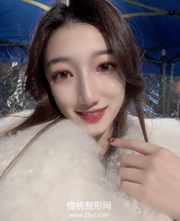 石家庄美莱李锦卓割双眼皮技术怎样?案例+价格表一览