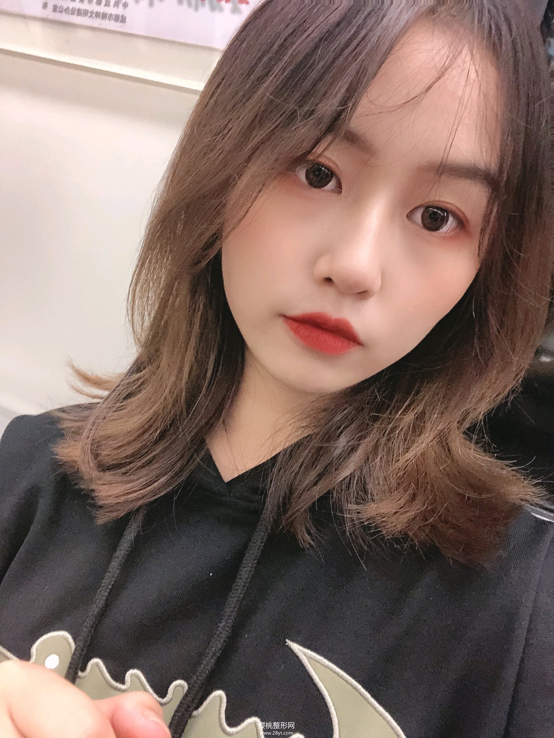 济南海峡徐永隆鼻怎么样?案例+价格表一览