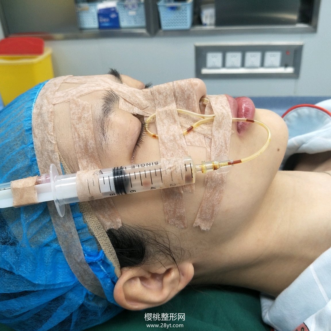 武汉匠歆天巧邓裴隆鼻技术如何?真人案例+最新价格表一览