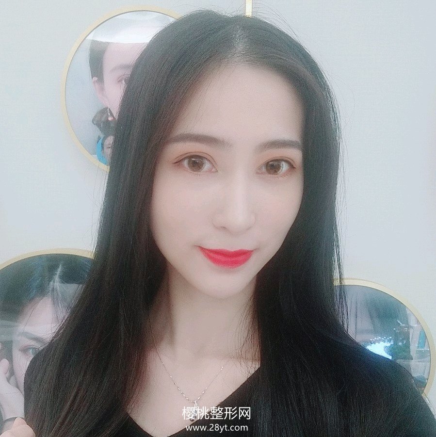 武汉匠歆天巧邓裴隆鼻技术如何?真人案例+最新价格表一览