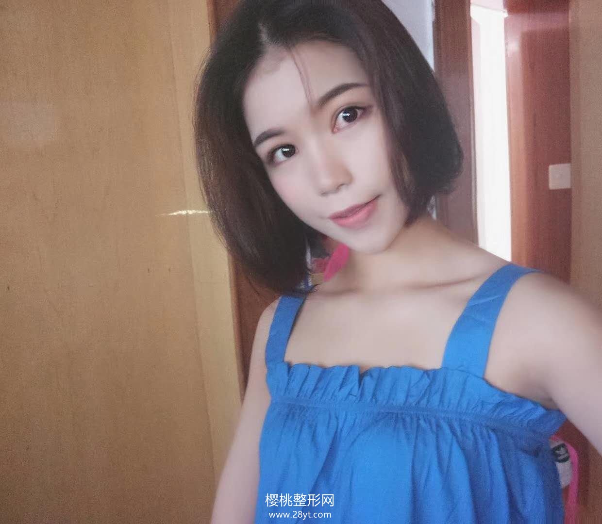 合肥华美赵辑双眼皮做的怎么样?有真人案例参考吗?贵不贵