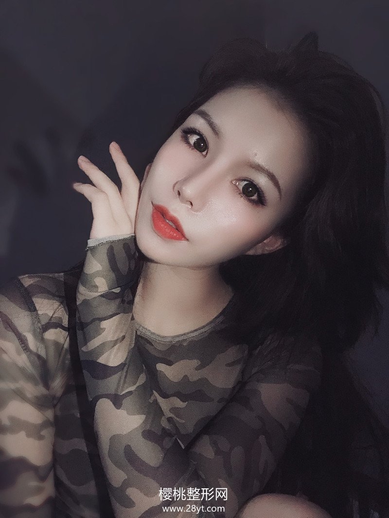 合肥华美赵辑双眼皮做的怎么样?有真人案例参考吗?贵不贵