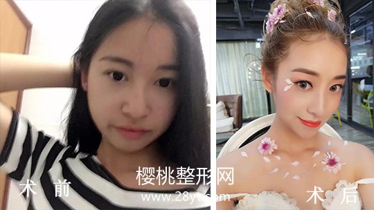 武汉伽美医疗美容整形医院正规吗?做整形价格贵不贵?
