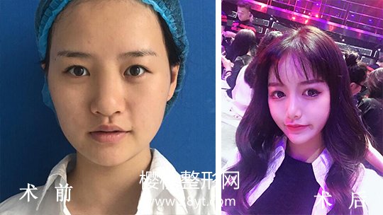 武汉伽美医疗美容整形医院正规吗?做整形价格贵不贵?