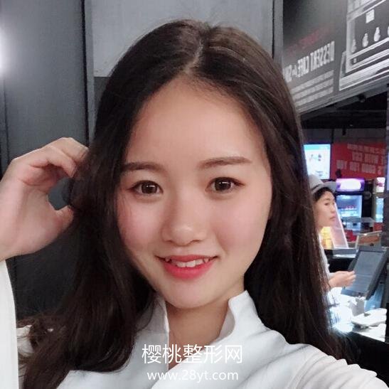 武汉伽美付毅做鼻子效果好不好?价格贵不贵?有真人案例参考吗?