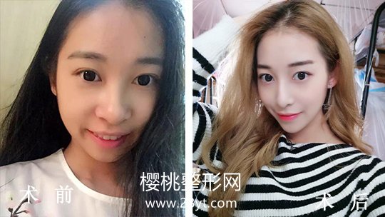 福州海峡美容医院口碑怎么样?附各项目价格表一览