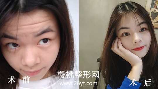 福州海峡美容医院口碑怎么样?附各项目价格表一览