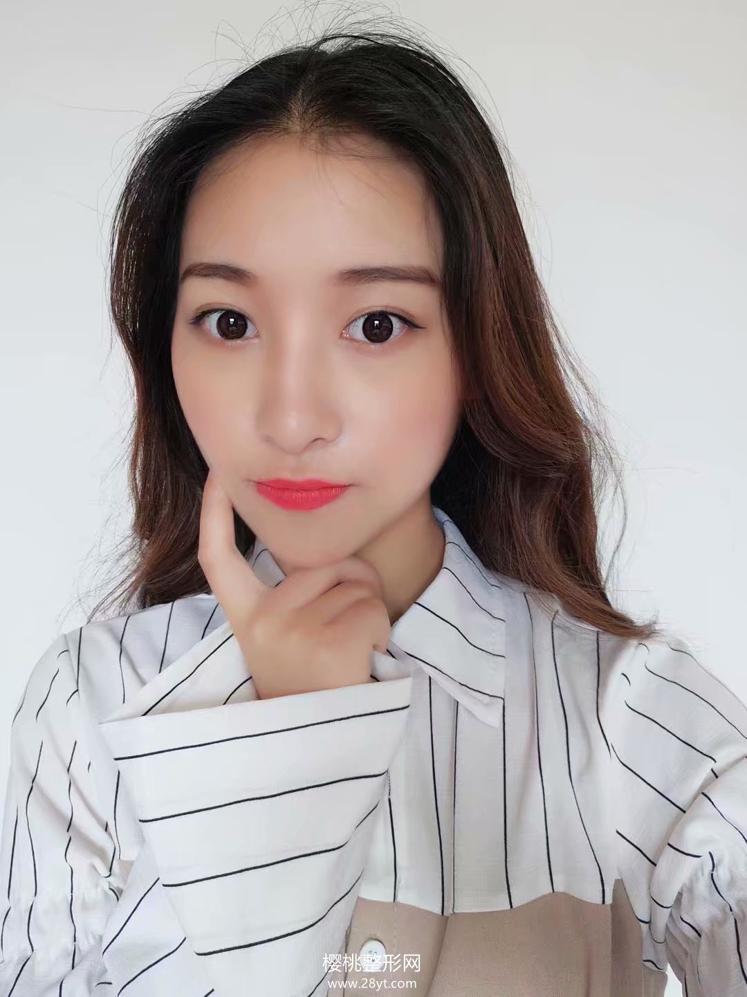 福州海峡薛克墘隆鼻技术怎么样?附真人案例+最新价格表一览