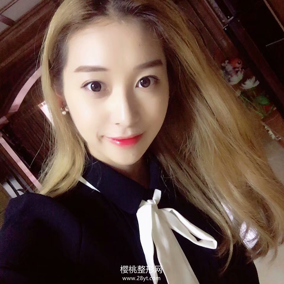 福州海峡薛克墘隆鼻技术怎么样?附真人案例+最新价格表一览