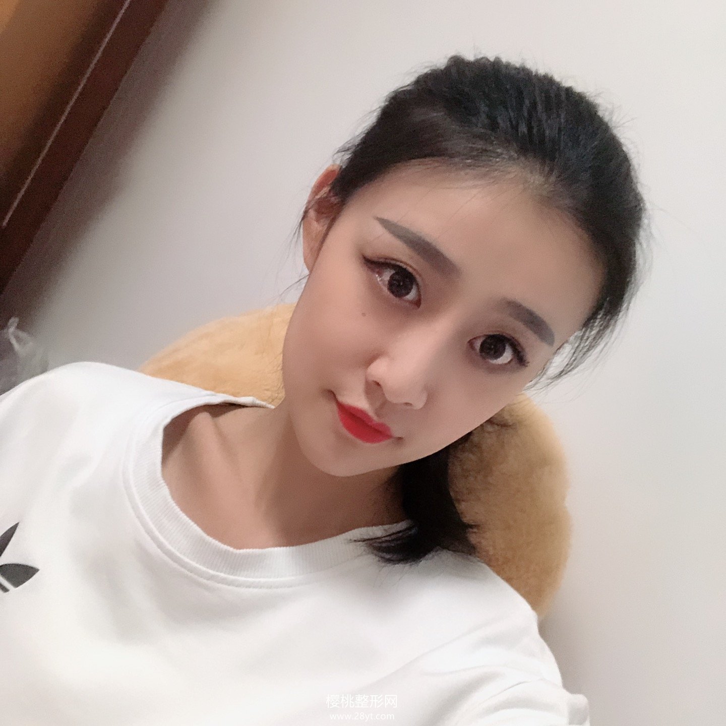 福州海峡李丽强做双眼皮技术怎么样?附真人案例+最新价格表一览