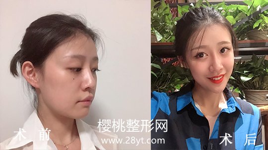 福州名韩整形美容正规吗?做整形价格贵不贵?