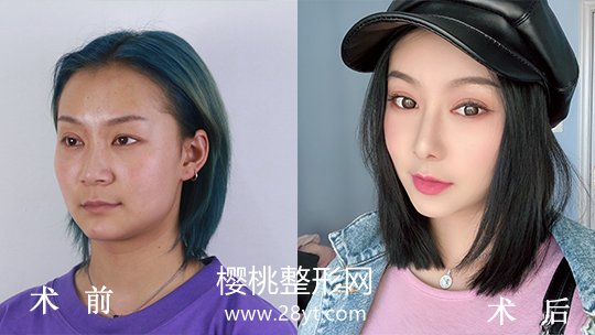 福州名韩整形美容正规吗?做整形价格贵不贵?