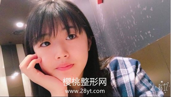 西安艺星宋蔚双眼皮案例分享+医生信息介绍