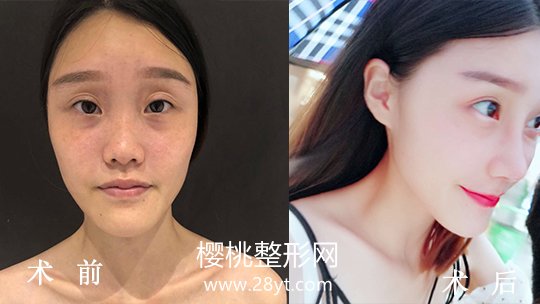 福州爱美尔医疗美容门诊部正规吗?做整形价格贵不贵?