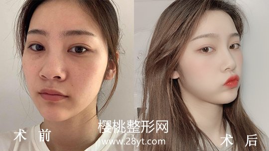 福州爱美尔医疗美容门诊部正规吗?做整形价格贵不贵?