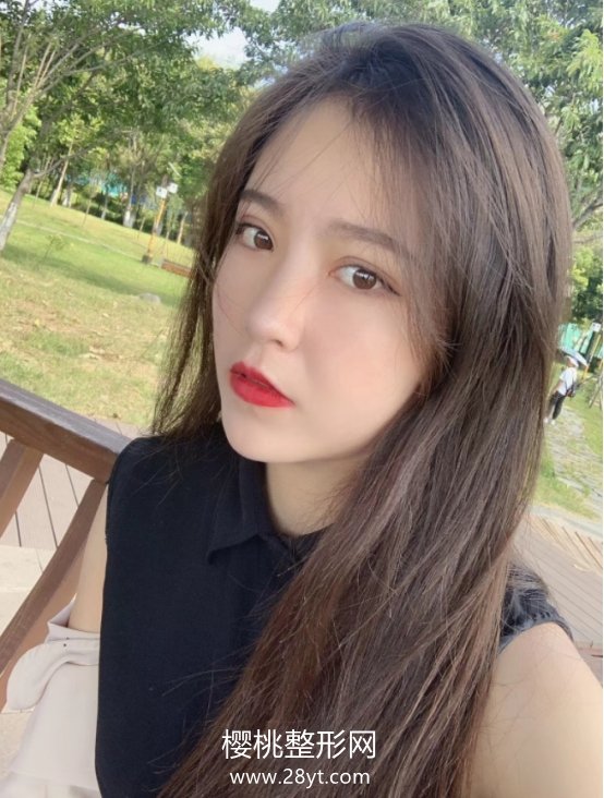 周鹏起做眼睛怎么样?术后二个月效果分享+医生信息介绍